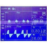 Factory Direct Sale Vet Animal Surgical Equipment Veterinary Anesthesia Machine thumbnail-5