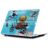 Full Body Laptop Skin Hard Equipment Case for Macbook A1181 Case Quality Choice thumbnail-4