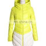 Long Style Slim Fit Woman Fashion Down Jacket for Winter Wear thumbnail-2