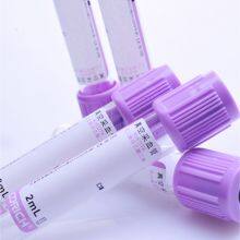 EDTA Tube Whole Blood Tubes Evacuated Blood Collection EDTA K2/ EDTA K3 Tubes, Test Tube for Blood Sample Colletion (CE)