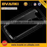 Express Wholesale Cell Phone Accessories China For OPPO N3 Covers For Mobile Phones,Cover For OPPO N3 Clear Crystal thumbnail-2