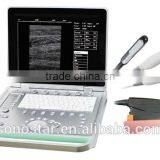 V7 Veterinary Ultrasound Vet Laptop Veterinary Radiology & Ultrasound Machine China thumbnail-1