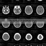 Konida Automatic Medical X-ray Film Agfa Fuji Dry Film thumbnail-2