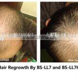 Professional Low Level Laser Therapy Hair Loss Treatment Hair Growth Machine To Men And Women thumbnail-5
