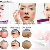 Best Facial Removal Salom Beauty Machine With Beauty Energy Bar thumbnail-6