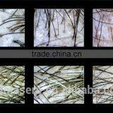 CE Professional Hair Growth /hair Restorer Equipment/ Low Level Diode Laser Therapy Hair Growth Device thumbnail-4