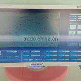 New Design Sperm Analyzer With ce thumbnail-5