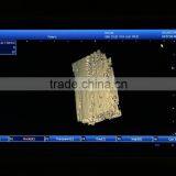 Laptop 3D Ultrasound Machine for Vet Use thumbnail-6