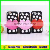 Mickey and Minnie Custom Silicone Mobile Phone Case Cover for LG G4 H818 Mobile Case Cover thumbnail-4