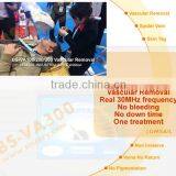 BS-VA300 HF Spider Vein HF Vascular Removal Beauty Machine thumbnail-6