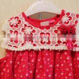 Wholesale Latest Style Baby Girls Dress Set Print Baby 2 Pcs Set Clothing Girl Set thumbnail-2