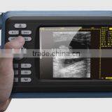 Veterinary Palm Ultrasound Scanner for Animal Use thumbnail-3