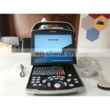 Good Quality Original Mindray DP-30 BW Portable Full Digital Ultrasound Machine Mindray DP 30 Ultrasound Machine thumbnail-2