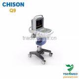 Medical Chison Portable 4d Color Ultrasound Chison q9