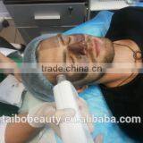 Varicose Veins Treatment New 2016 Beauty Salon Equipment Portable Nd Yag Laser Machine Prices/tattoo Anesthetic/q-switch Nd Yag Laser Naevus Of Ota Removal thumbnail-4