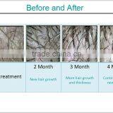 Diode Laser Hair Regrowth Machine/laser Cap for Hair Growth/hair Loss Treatment for Salon and Hair Transplantation Center thumbnail-5