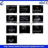 3d/4d Ultrasound Scanner thumbnail-6
