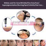 Micro Needle Cartridge Supplier 1 3 5 7 9 12 36 42 Nano for Microneedling Pen, Electric Dermaroller dr Pen Needle thumbnail-5