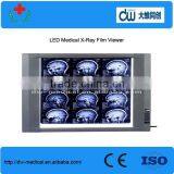 Digital x Ray Film Reader thumbnail-1