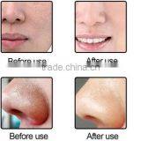 Black Head Remover Machine thumbnail-4