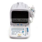 Beautiful Compact Diagnostic Ultrasound Probe / Mini Ultrasound Machine / Portable Ultrasound Scanner thumbnail-3