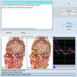 2017 Composition Analyze Equipment 9D NLS Sub-health Detector Best 9d Nls Diagnostic Scanner thumbnail-4