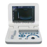 Carejoy Laptop Ultrasound Machine/Scanner With Convex Probe Ultrasonic Diagnostic System by CE ISO thumbnail-3
