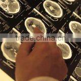 Dry Thermal Film,dry X-ray Film, Dry Imaging Film thumbnail-1