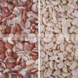 Seed Color Sorter/oil Seed Color Separator/oil Seed Processing Equipment thumbnail-5