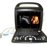 Премиумный 4D цветной допплеровский ультразвуковой сканер thumbnail-1