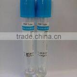 Steriled PRP Tube Used for Prp Treatment thumbnail-1