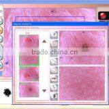 Portable Facial Skin Analyzer thumbnail-1