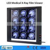 LED Medical X-ray Film Viewer or Negatoscope thumbnail-1