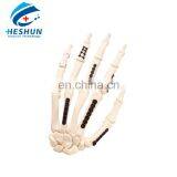 Orthopedic Plates for Fixation of Mini Bone Fractures thumbnail-1