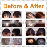 Hair Growth Electric Scalp Stimulator Device thumbnail-6