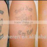 Most Effective Tattoo Removal Laser Equipment Removal Tattoo Laser thumbnail-4
