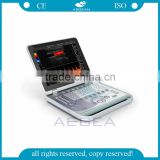 AG-BU005 Notebook type doppler type B mode ultrasonic