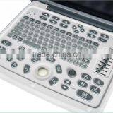 Factory SUPPLY Portablolor Ultrasound Machines/ultrasound Scanner CE Approval Doppler Ultrasound Scanner thumbnail-5