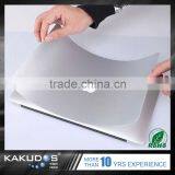 2016 Brand New 12 Inch Laptop Skin Stickers for Macbook Retina