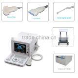 CE Approved Portable USB Ultrasound Scanner With 3.5Mhz Multi-frequency Convex Probe RUS-6000D thumbnail-1