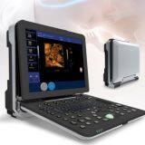 ZERO-C300 3.0V 4D Ultrasound Machine thumbnail-1