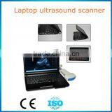 New CE Approved Laptop Ultrasound Scanner 10 Inch Suitable Transport thumbnail-1