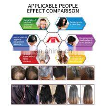 650nm Diode Laser SPA Scalp Treatment Machine With Hair Analysis Camera Professional Hair Regrowth Machine for Hair Salon thumbnail-5