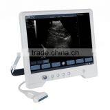 B Mode Portable Ultrasound Price TS20 thumbnail-2