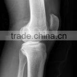 Fuji Dihl /medical Surgical Film/xray Medical Dry Laser Imaging X-ray Film thumbnail-5