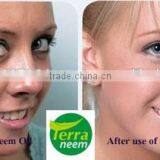 NEEM OIL IN BULK thumbnail-5