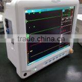 High Quality Multi Parameter Function Patient Monitor Digital Manufacturer thumbnail-4
