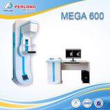 Digital X-ray Machine for Mammography Screening MEGA 600 thumbnail-1