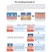 Newest Portable Face Lift Skin Tightening Probe Flx Fractional Rf Microneedle Treatment Machine thumbnail-4