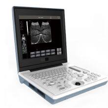 SS-6B Laptop All-Digital Ultrasound thumbnail-4